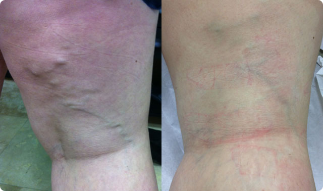 , Patient Testimonials Before and After Photos